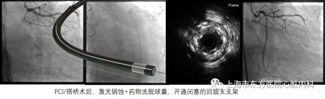 微信图片_20190717080318.jpg 微信图片_20190717080318.jpg