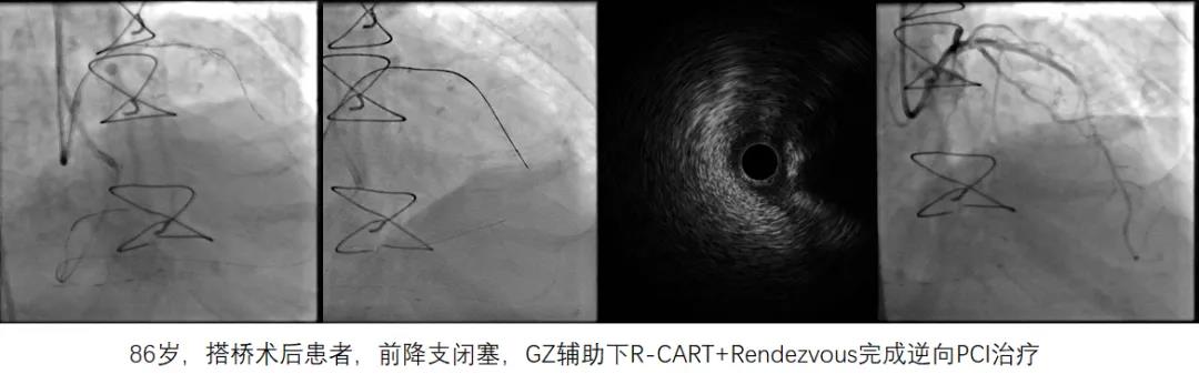 微信图片_20190717080342.jpg 微信图片_20190717080342.jpg