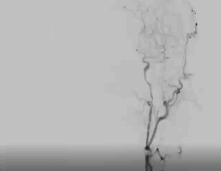 4.gif