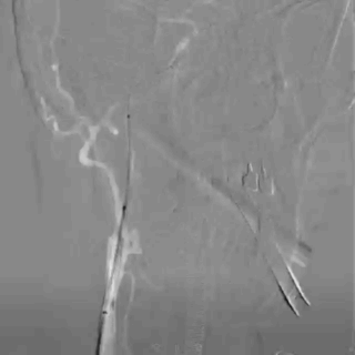 6.gif