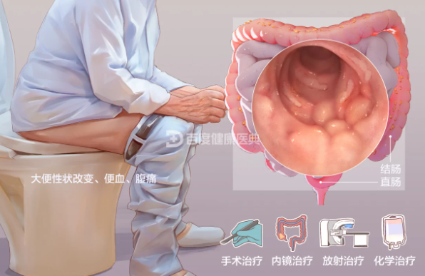 图片17.png